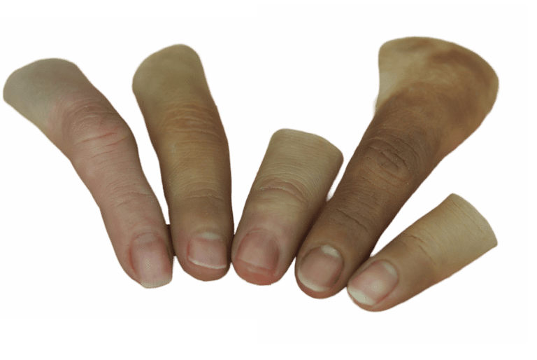 Restauración anatómica de dedos amputados * ART LAB