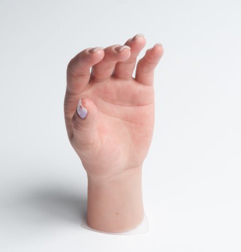 Prótesis para mano de mujer
