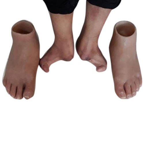 Prótesis anaplastología pie parcial