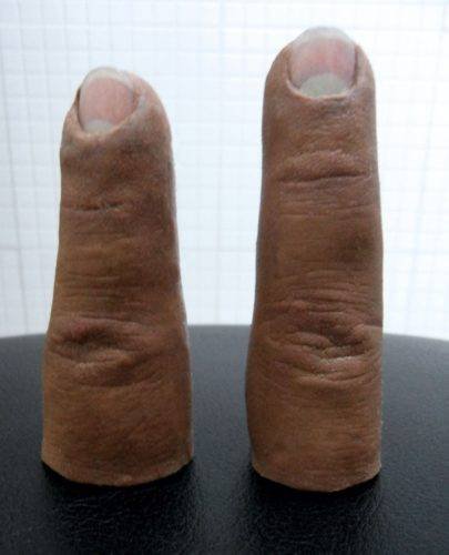 Prótesis de silicona para dedo índice y medio * Prothesis ART LAB