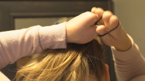 La rehabilitación emocional en la amputación traumática * ART LAB