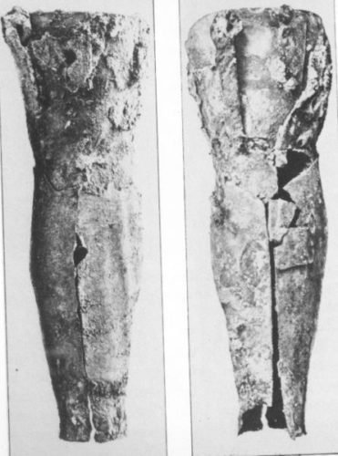 Las Prótesis Desde La Antigüedad Hasta La Primera Guerra Mundial