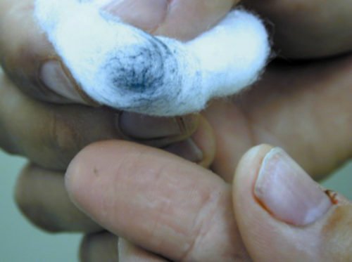 Prótesis dedo resistente al fuego* ART LAB