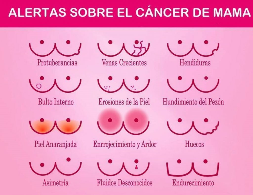 Señales de advertencia del cáncer de mama * ART LAB