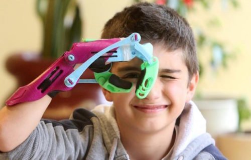 Prótesis Hechas Con Impresoras 3D