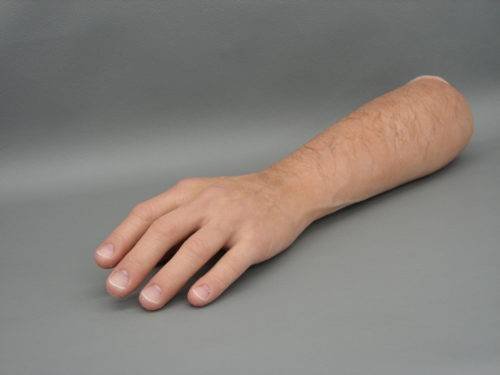 Prótesis de mano y brazo * ART LAB