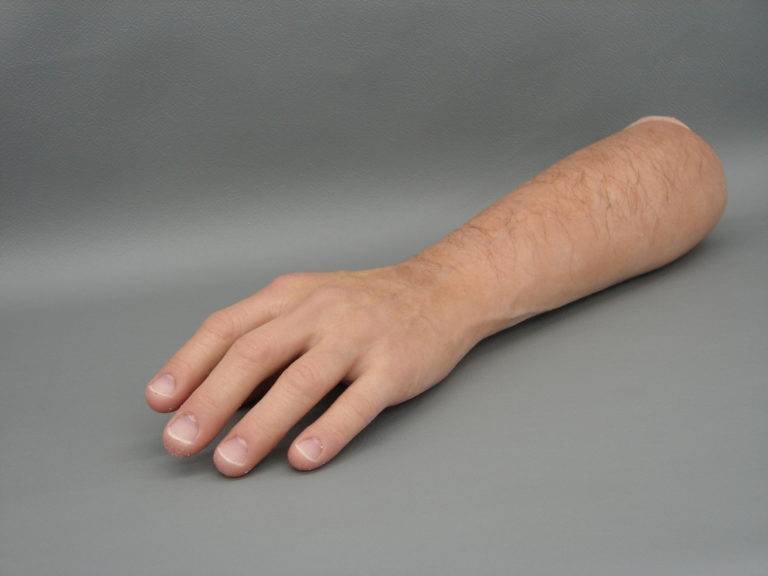 Prótesis de mano y brazo * ART LAB