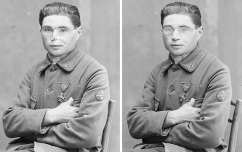 Prótesis Nariz para soldado de la primera guerra mundial * ART LAB