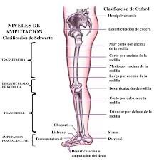 Amputación miembro inferior * ART LAB