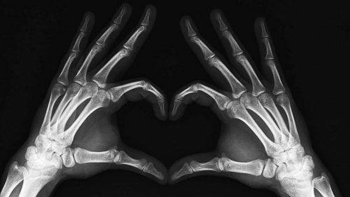 Anatomía de la mano * Prótesis ART LAB