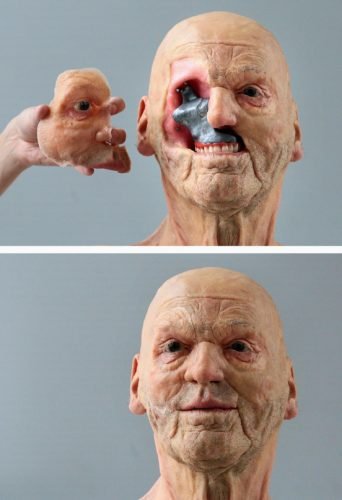 Ejemplo anaplastología facial * ART LAB