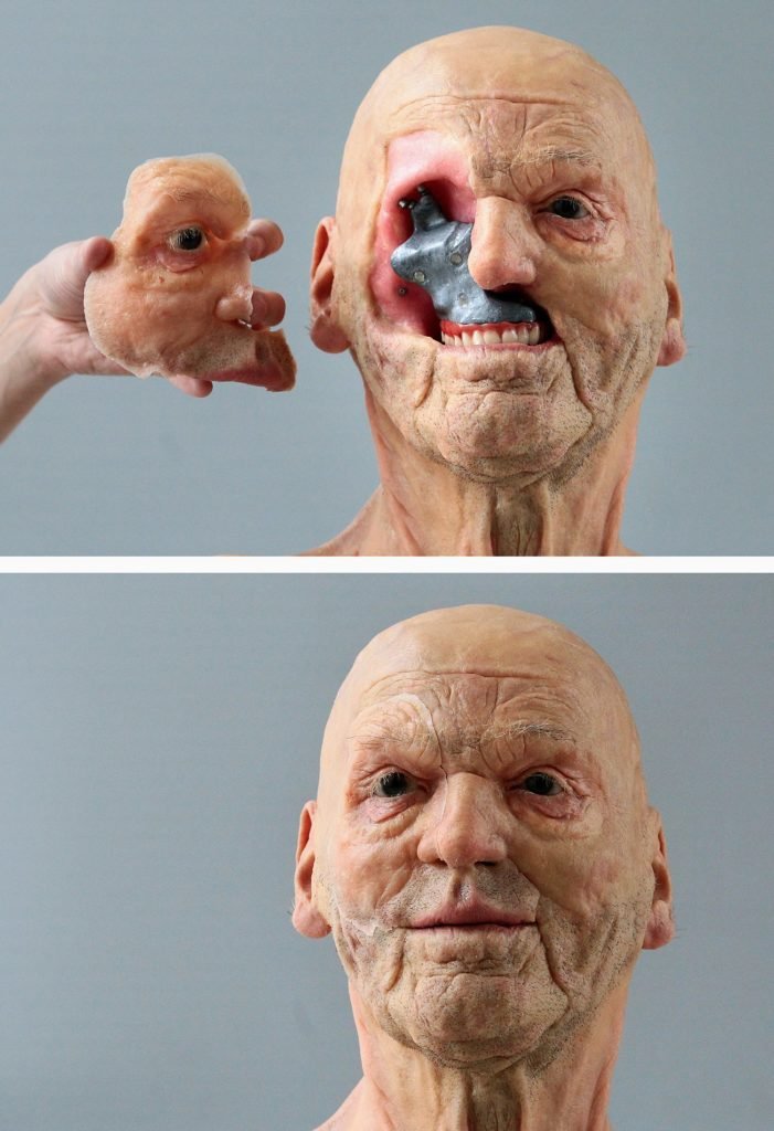 Ejemplo anaplastología facial * ART LAB