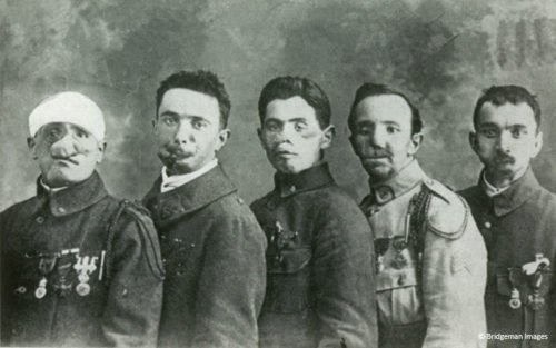 Soldados franceses con cicatrices faciales por la primera guerra mundial * ART LAB