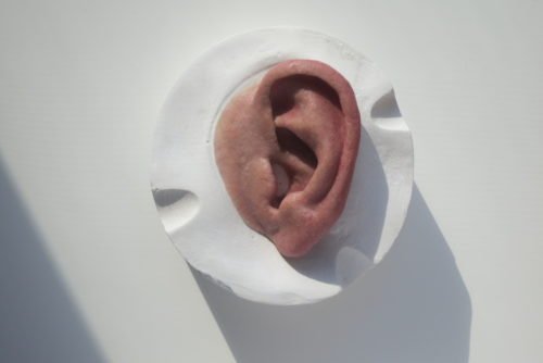 Prótesis oreja anaplastología * Prothesis ART LAB