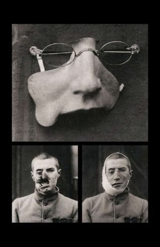 Prótesis facial de hojalata * ART LAB