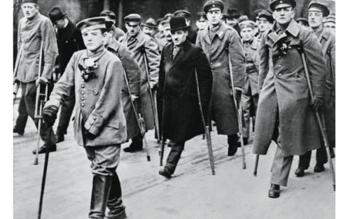 Las Prótesis Desde La Antigüedad Hasta La Primera Guerra Mundial