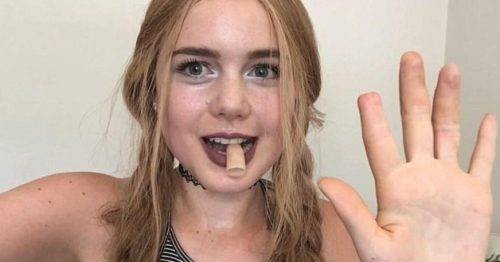 Elle Lietzow enseñando amputación dedo índice y la prótesis en su boca * ART LAB