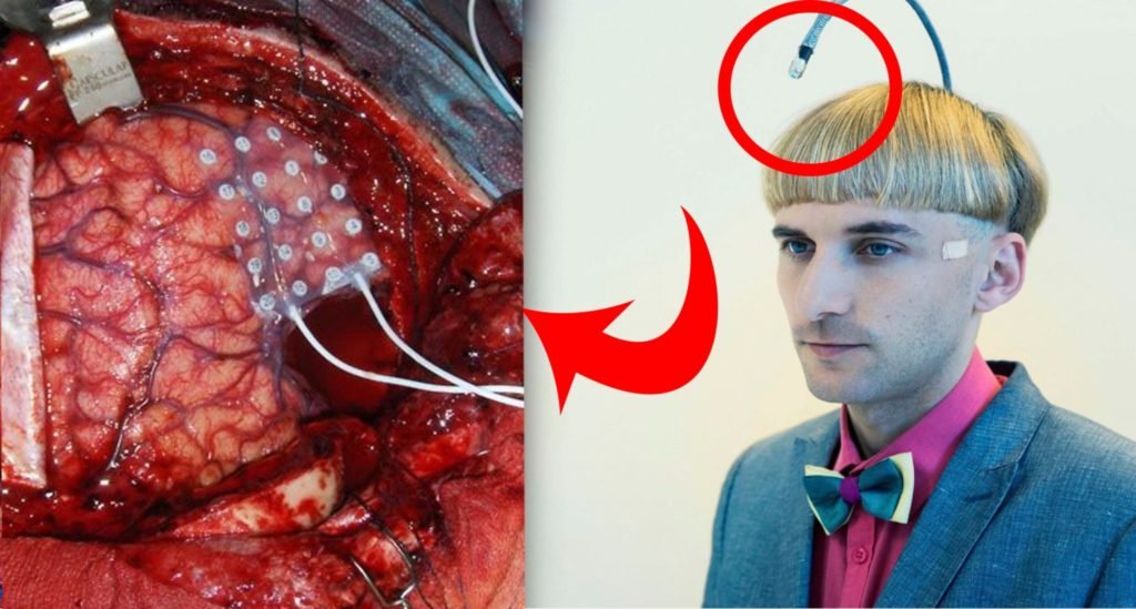 Neil Harbisson X Neil Harbisson primer cyborg