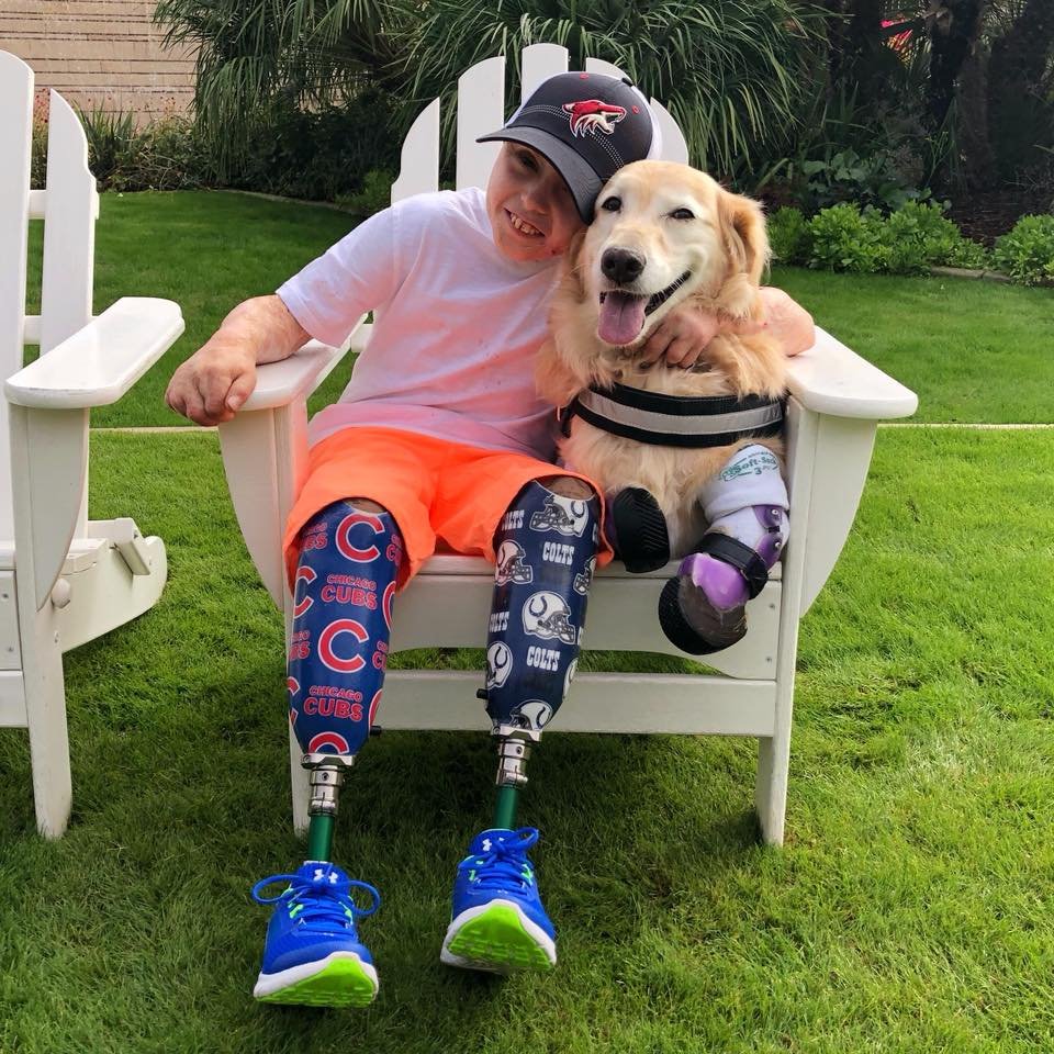 Niño Con Amputación Bilateral De Sus Piernas Conoce A La Perra Chi Chi