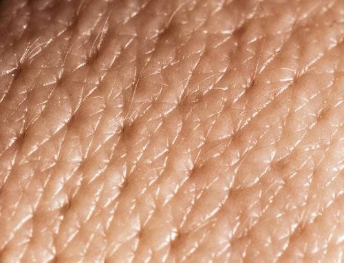 Capa epidermis * ART LAB