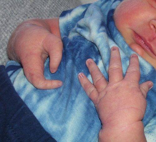 Malformación congénita * ART LAB