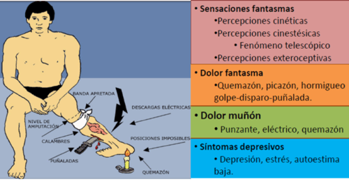 Síntomas dolor fantasma * ART LAB