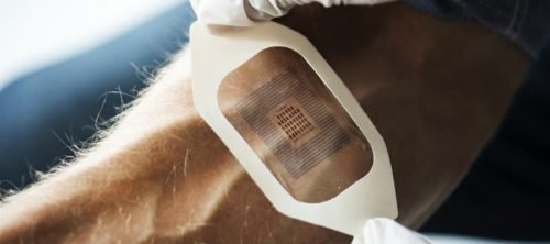 Implante de biosensores, wearables y biotecnología virtual en el brazo * ART LAB