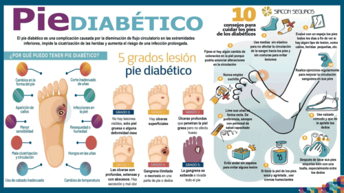 Recomendaciones cuando tienes pie diabeto * ART LAB