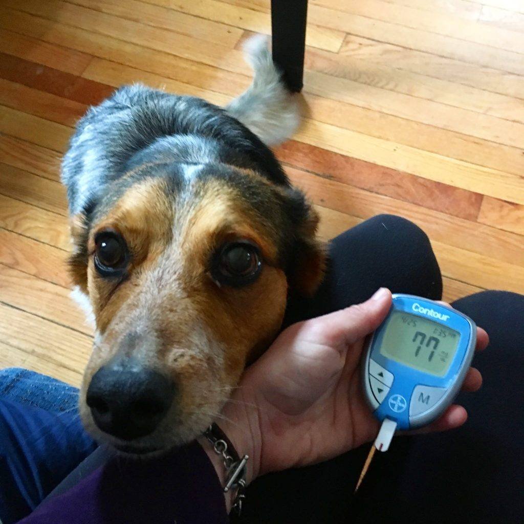 Detección cambios hipo-hiperglucemia