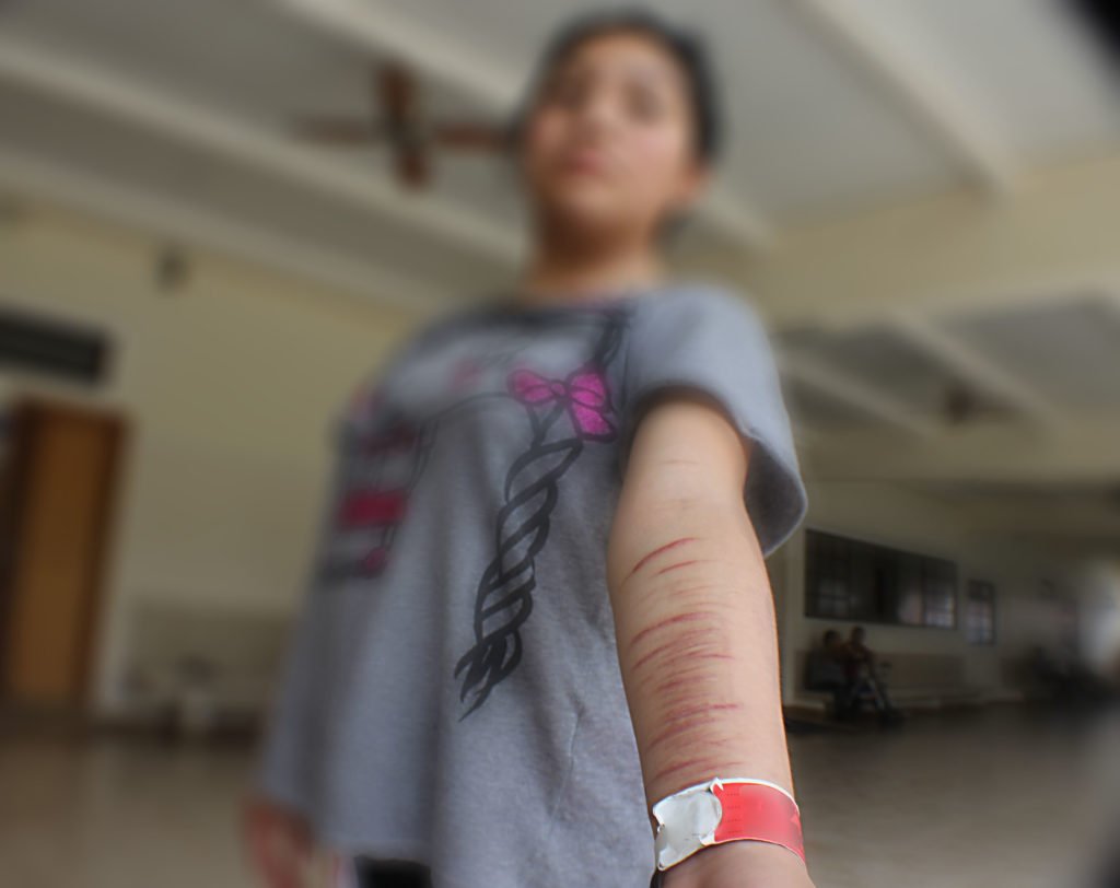 Self Injury, Risuka, Autolesión o Cutting * ART LAB