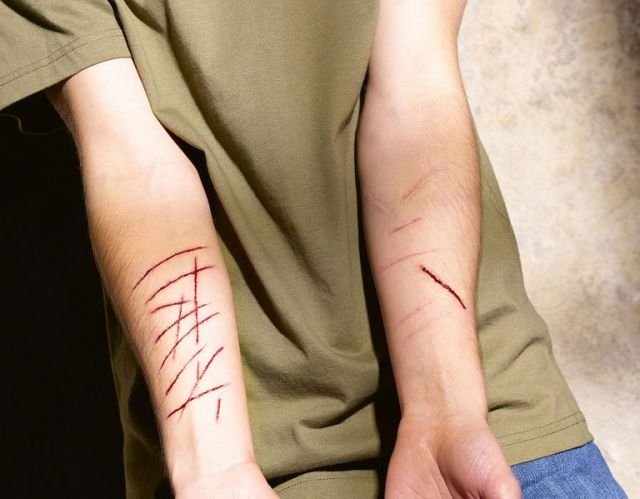 Cutting, Self Injury, Risuka o Autolesión