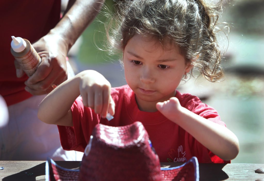 Niña con amputación congénita mano izquierda * ART LAB
