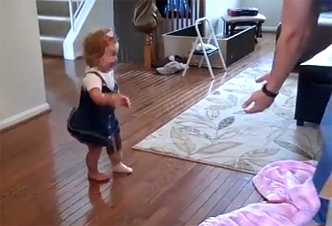 Amputación pierna izquierda en la infancia * ART LAB