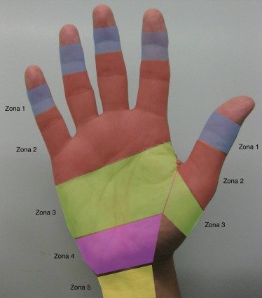 Zonas de verdan de la mano o zonas flexoras * ART LAB