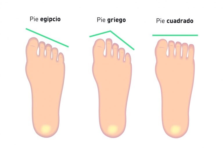 Clasificación morfológica de los pies: griego, cuadrado y egipcio * ART LAB