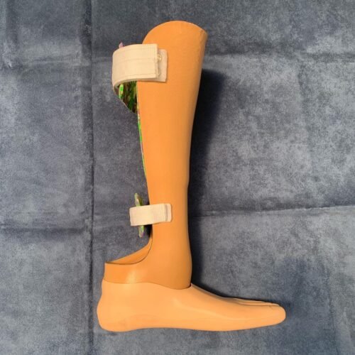 Prótesis para amputación chopart * ART LAB