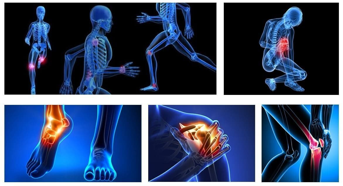Las lesiones en el cuerpo humano - Lesiones Pág.1
