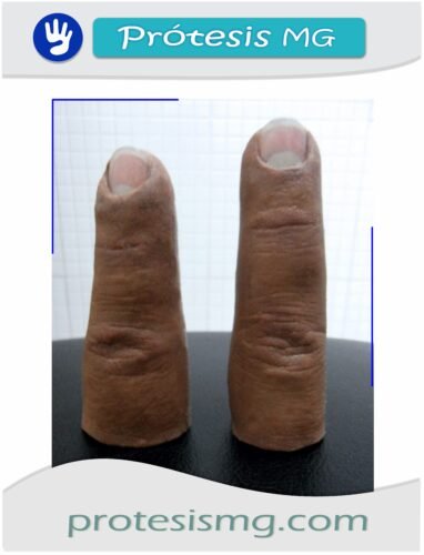 Prótesis De Dedos