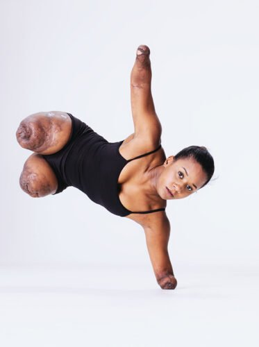 Kiera Brinkley con amputación de sus extremidades de Portland, Oregon, EE. UU. * ART LAB