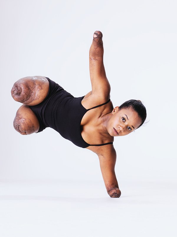 Kiera Brinkley con amputación de sus extremidades de Portland, Oregon, EE. UU. * ART LAB