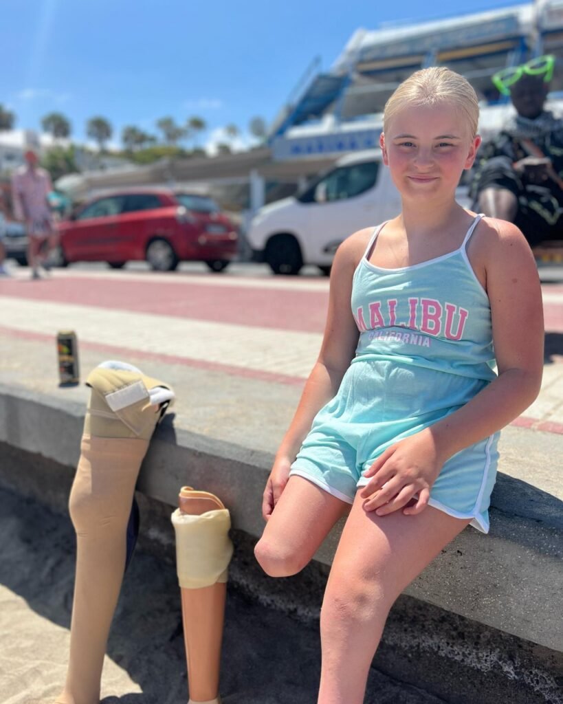 When she was just 18 months old, her legs were amputated.