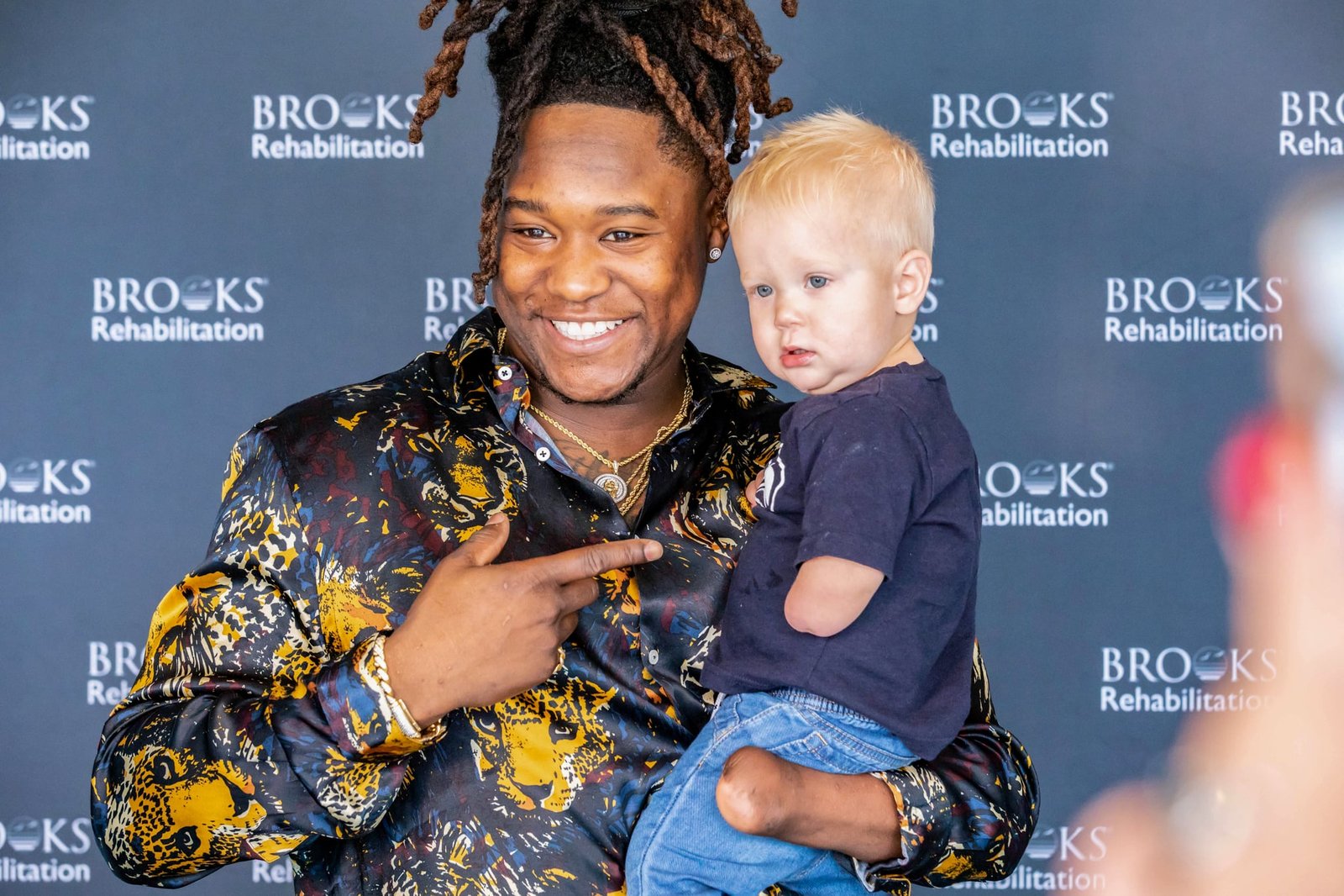Shaquem Alphonso Griffin was born with amniotic band syndrome affecting his left hand, causing his fingers on his left hand not to fully develop.
