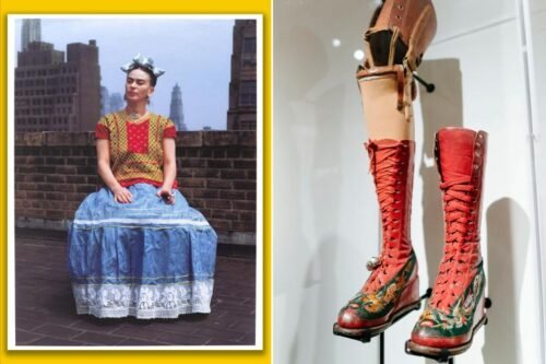 Frida Kahlo gangrene set into her right foot and her leg had to be amputated below the knee