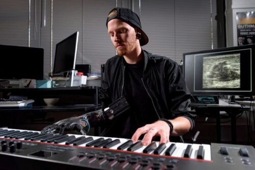 Jason Barnes Is A Musician Again With A Robotic Hand