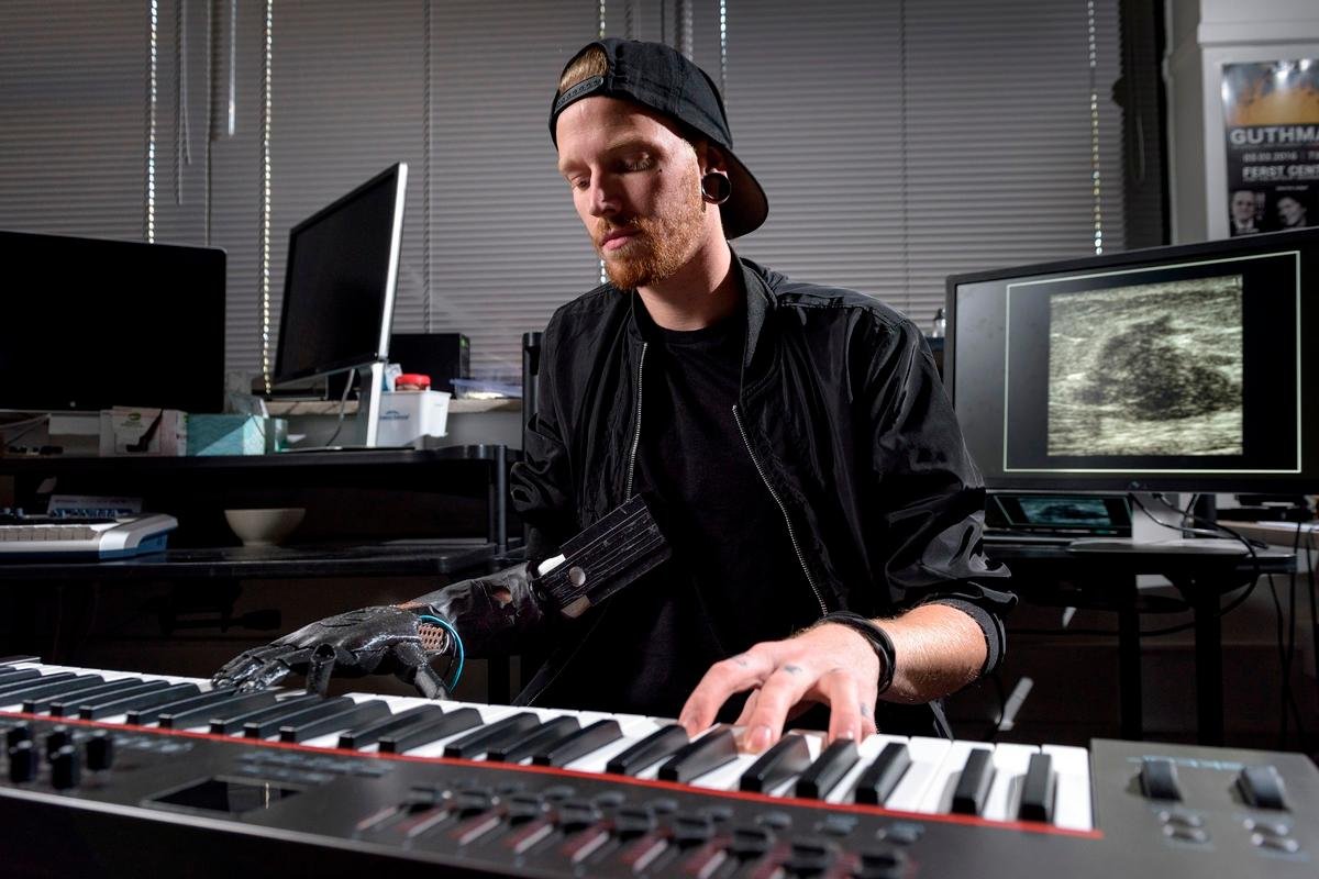 Jason Barnes Amputee Drummer - Jason Barnes is a musician again with a robotic hand