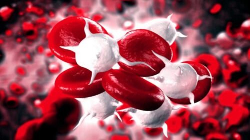 Blood infection