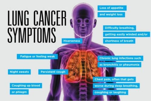 Lung cancer