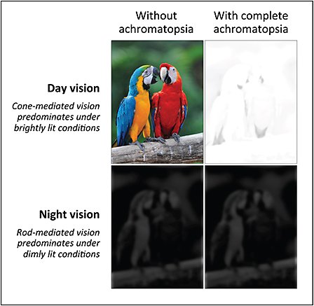 Achromatopsia, also known as Rod monochromacy, is a medical syndrome that exhibits symptoms relating to five conditions, most notably monochromacy.