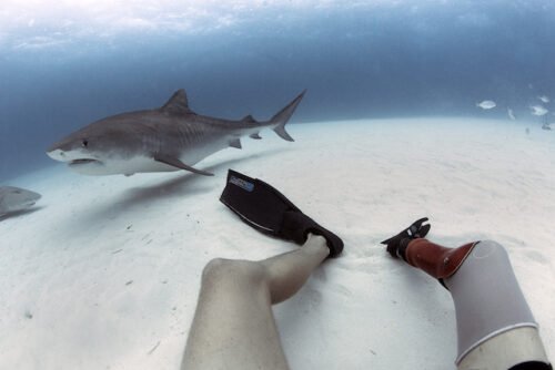 Amputated for shark attack MikeCoots
