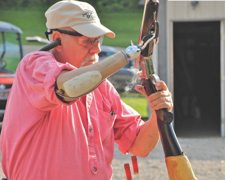 Amputation in Gun-Shot fractures, also a gunshot wound (GSW) is a penetrating injury caused by a projectile (e.g. a bullet) from a gun (typically firearm or air gun)
